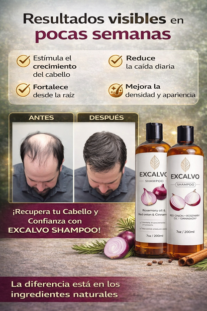 Excalvo- Dile adios a la caspa y la calvicie